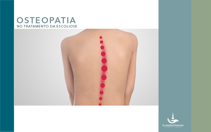 Osteopatia na escoliose